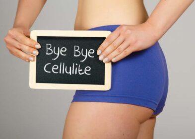 What causes stubborn cellulite? And how to get rid of cellulite?