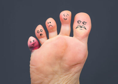 7 TRIED AND TESTED WAYS ON HOW TO GET RID OF CORNS ON FEET