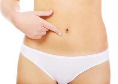 How to Get Rid of Stretch Marks – The Ultimate Guide