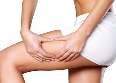 How To Get Rid of Cellulite : Ways To Say Your Cellulite Goodbye