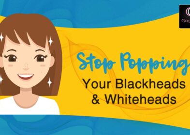 How to Get Rid of Blackheads and Whiteheads Overnight
