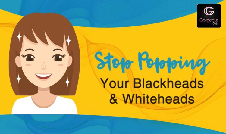 How to Get Rid of Blackheads and Whiteheads Overnight