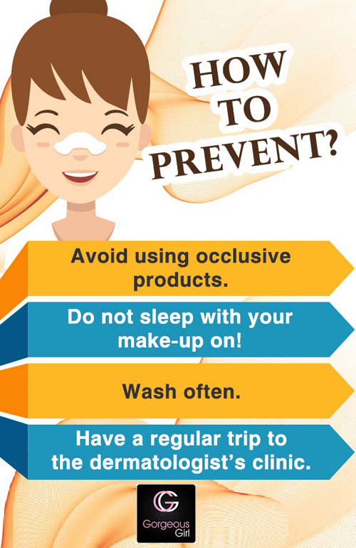 How to prevent blackheads