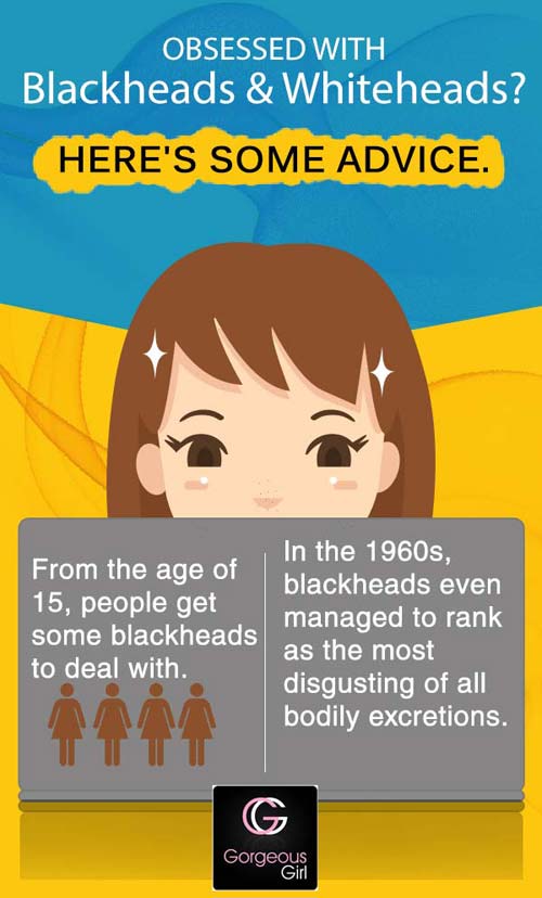 Blackheads and whiteheads