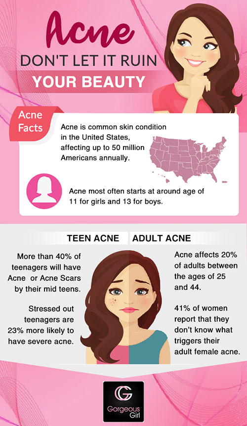 Teen acne and adult acne