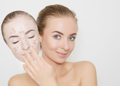 Blackhead On Nose? These 3 Ways Can Help You Get Rid Of Them