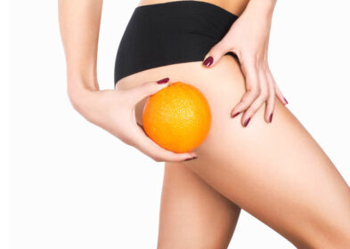 Get Rid Of Cellulite On Legs & Thighs- Crazy Methods To Prevent It
