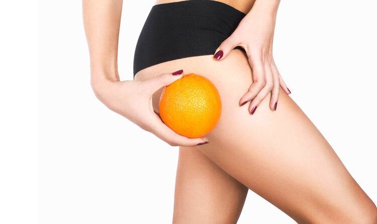 Get Rid Of Cellulite On Legs & Thighs- Crazy Methods To Prevent It