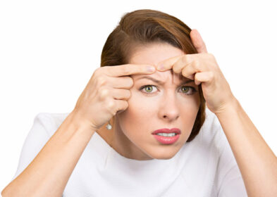 What Causes Whiteheads? What To Do To Prevent Future Breakouts?