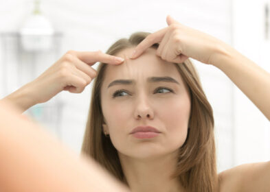 What Are White Bumps on Face? Five Easy Methods to Get Rid of Them