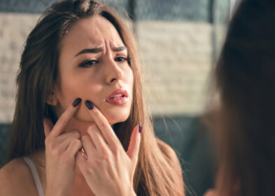 Suffering From Pimples,Whiteheads And Blackheads? Here’S The Solution