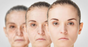 Photoaging Vs Normal Aging: Causes, Symptoms And How To Treat It