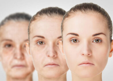 Photoaging Vs Normal Aging: Causes, Symptoms And How To Treat It
