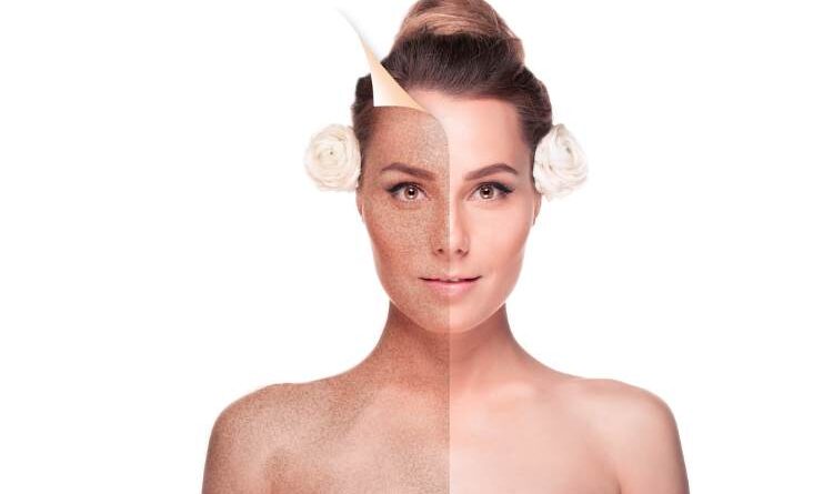 Age Spots On Face: Causes, Symptoms And How To Remove Age Spots