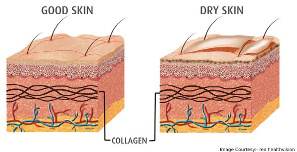causes of dry skin