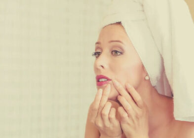 How To Get Rid Of Hormonal Acne: 9 Easy Ways To Treat It Fast