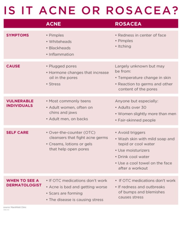 acne or rosacea