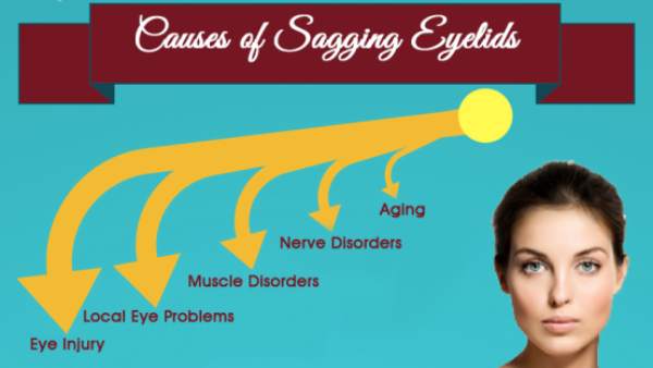 Causes Of Sagging Eyelids