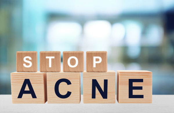 Lemon Water Prevents Acne