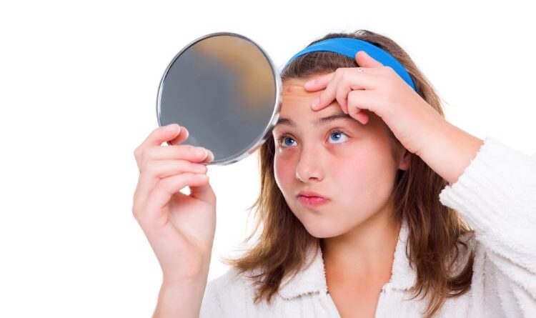 Teenage Acne Treatment: Treat Your Acne And Have A Clear Facial Skin