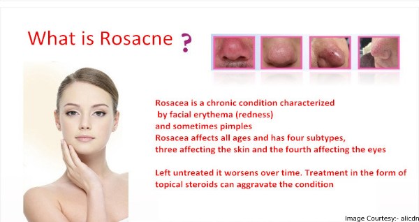 what foods cause acne rosacea