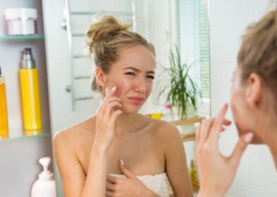 How To Get Rid Of Hives? Know 7 Different Ways For Hives Treatment