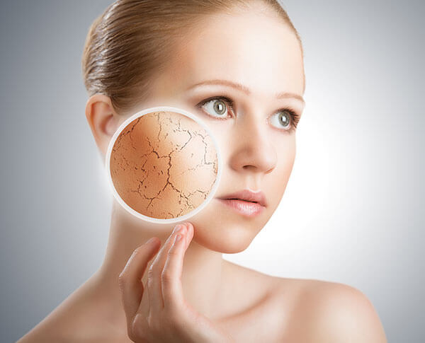 keratosis pilaris causes