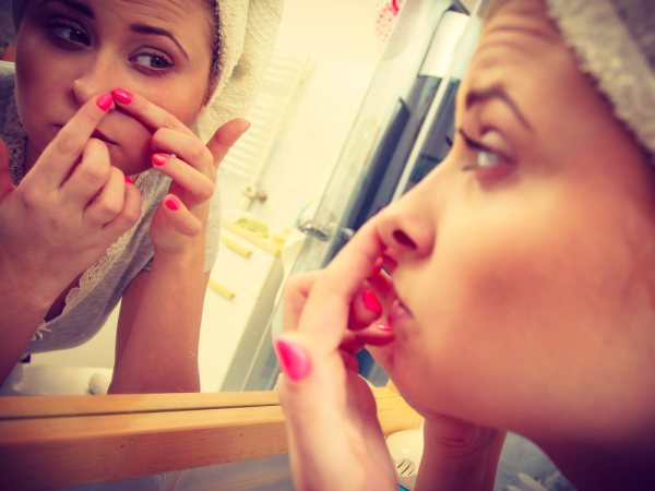 Should I Pop Whiteheads