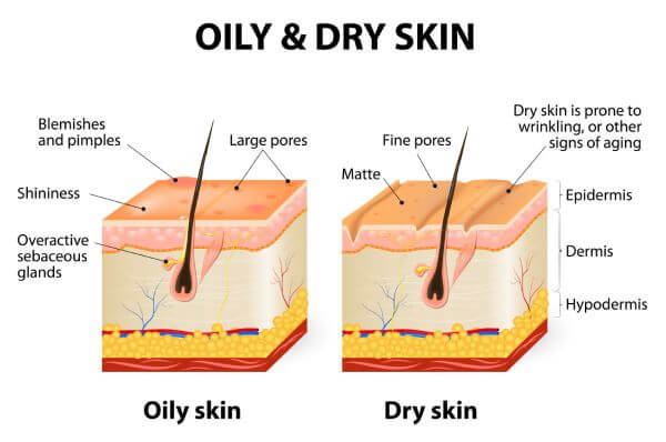Skin Types