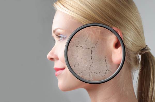 What Is Xerosis Cutis
