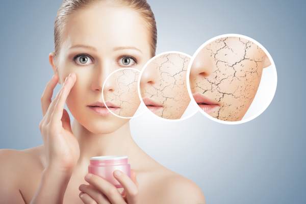 What Is Xerosis Cutis Or Abnormally Dry Skin? Know All