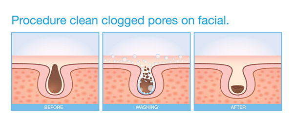 How Do You Minimize Pores