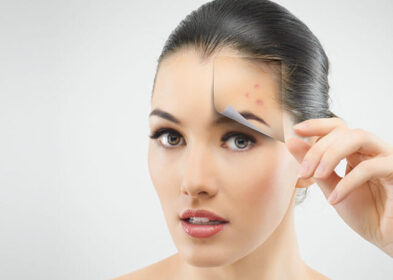 How To Get Rid Of Bumps On Face: 5 Most Effective Ways To Treat