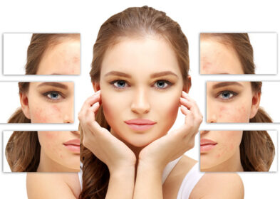 How To Shrink Pores: 7 Proven Ways To Shrink Your Pores Easily