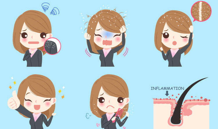 Itchy Scalp Causes And 7 Recommended Ways To Treat The Itchy Scalp