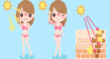 Sunburn Peeling: Why It Happens And What You Can Do About It!