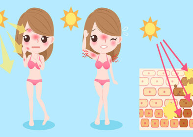 Sunburn Peeling: Why It Happens And What You Can Do About It!