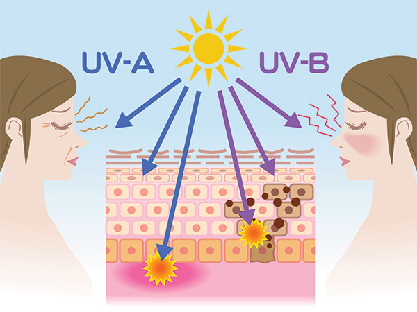 UV rays effects and aging 