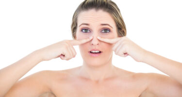 How To Remove Blackheads: 7 Ways To Get Fast And Effective Results