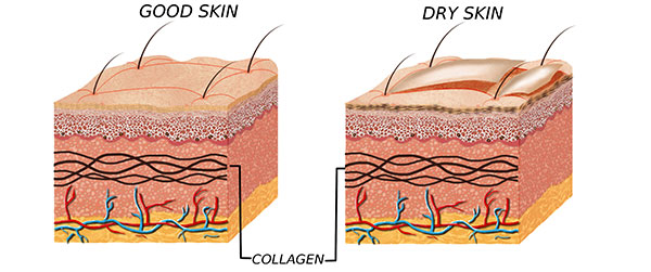 causes of dry skin