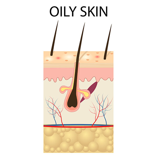 Oily Skin With Clogged Pores