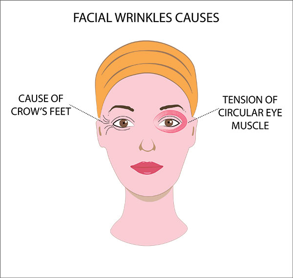 causes of wrinkles on face