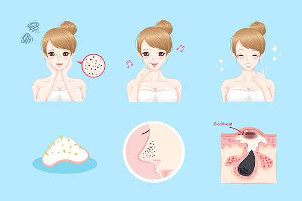 symptoms of blackheads