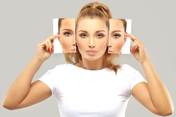 vitamin e for scars on face can only address hyperpigmentation