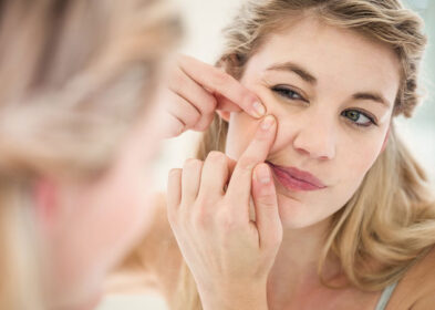 7 Reasons What Causes Blackheads And How To Remove Them From Roots