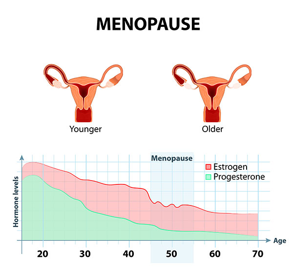 when women reach menopause