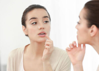 Cold Sore Or Pimple: What Exactly You Have And How To Treat It