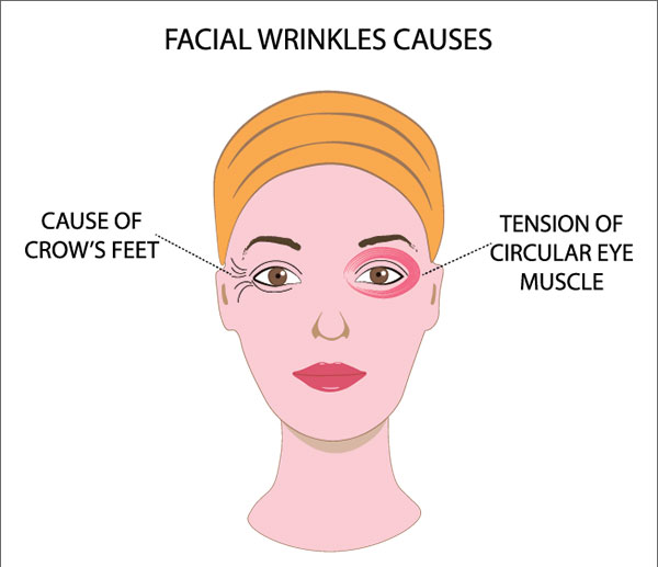 facial wrinkles