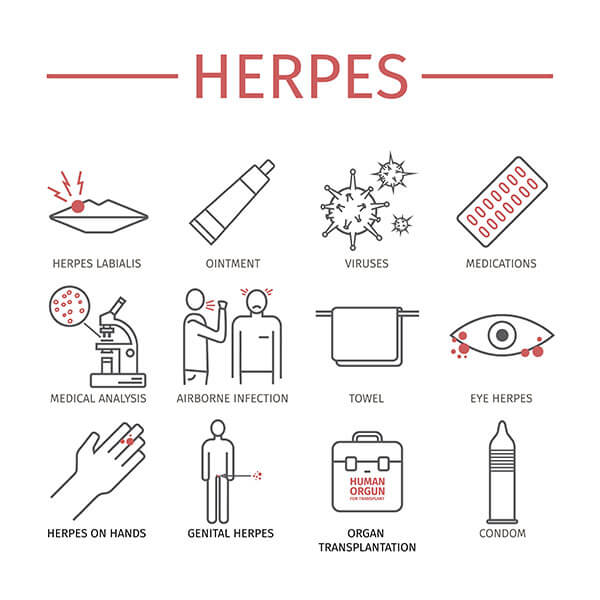 treatment for cold sore or herpes