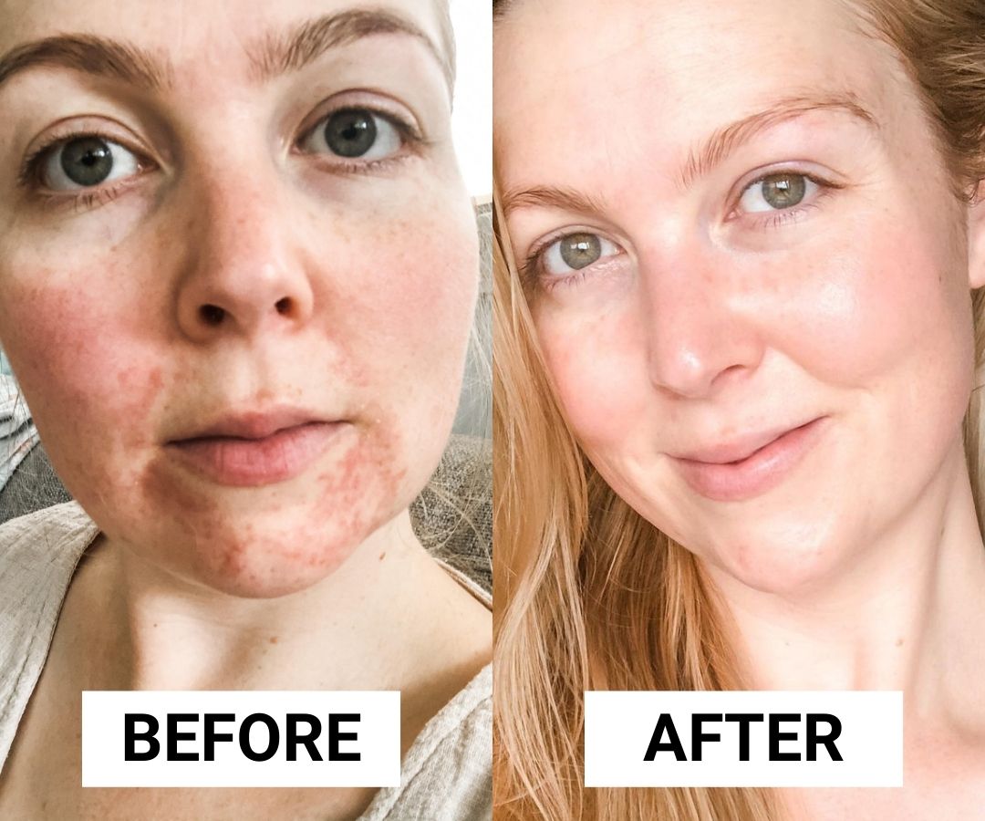 Tolerance Extreme Mask Before and After Pictures